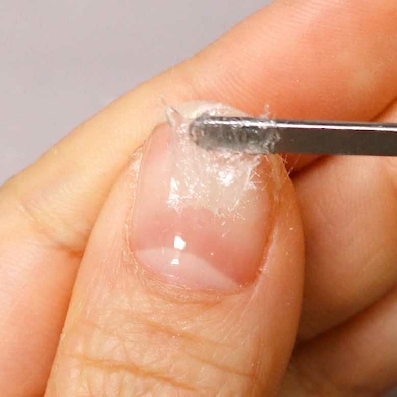 割れ欠けの補強